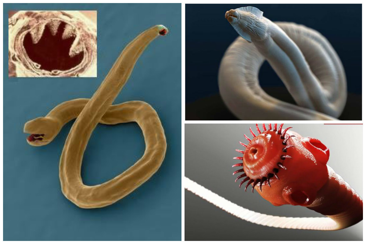 Строение внутренних паразитов. Гельминты паразитические черви. Гельминты паразитические черви у человека. Кишечные паразитические черви. Черви в организме человека гельминты.