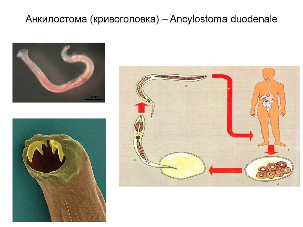 Перкутанный путь заражения. Анкилостома (Ancylostoma duodenale) жизненный цикл. Паразиты у человека анкилостома. Анкилостома это биогельминт.